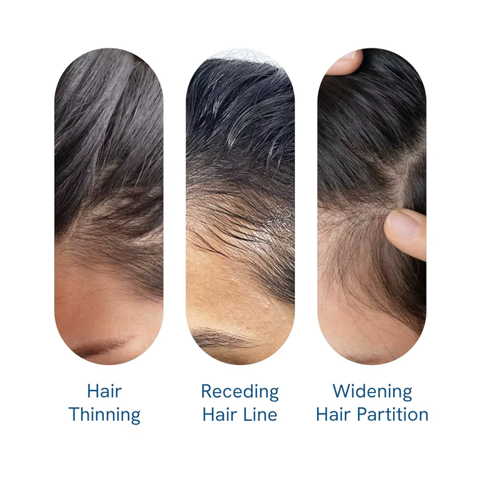 Be Bodywise Rosemary Hair Growth Serum Roll Dht-Blocking Scalp Serum Boosts Oxygen Flow, Reduces Hair Fall Paraben/Sulfate-Free