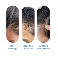 Be Bodywise Rosemary Hair Growth Serum Roll Dht-Blocking Scalp Serum Boosts Oxygen Flow, Reduces Hair Fall Paraben/Sulfate-Free