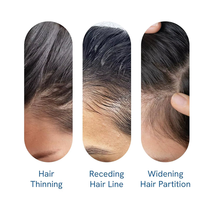 Be Bodywise Rosemary Hair Growth Serum Roll Dht-Blocking Scalp Serum Boosts Oxygen Flow, Reduces Hair Fall Paraben/Sulfate-Free
